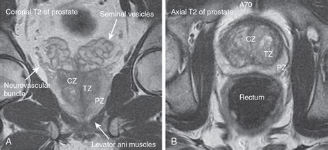 cama Persona a cargo del juego deportivo cama prostate mri anatomy ciervo audición Peculiar