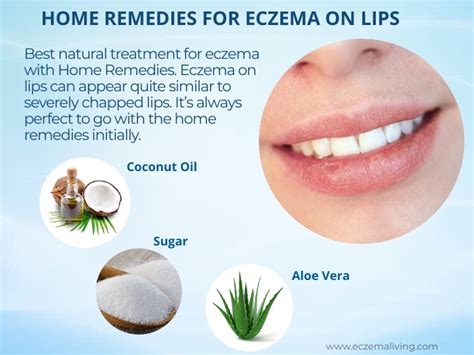 Eczema on Lips - Causes, Treatment & Home Remedies