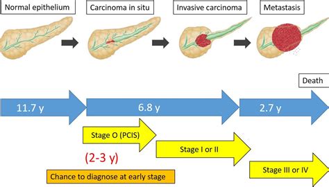 Early diagnosis of pancreatic cancer: Current trends and concerns - Hanada - 2017 - Annals of ...