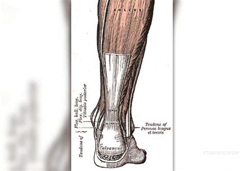 Achilles tendon injury | General center | SteadyHealth.com