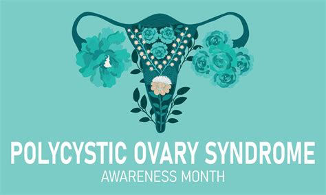 PCOS awareness month 10597627 Vector Art at Vecteezy