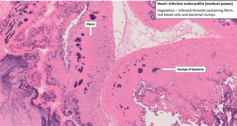 Heart Endocardium Histology