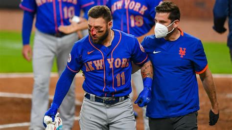 Mets' Kevin Pillar suffers multiple fractures after getting hit in face ...