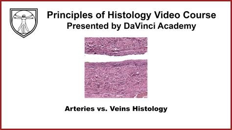 Arteries vs. Veins Histology [Cardiovascular 2 of 4] - YouTube