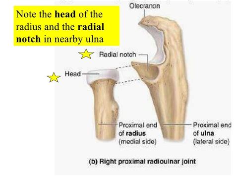 Radial Notch Of Ulna Articulates With - cloudshareinfo