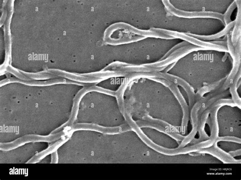 Lyme Disease, Borrelia burgdorferi Bacteria, SEM Stock Photo - Alamy