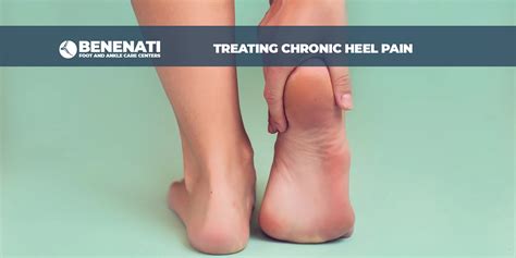 Treating Chronic Heel Pain | Benenati Foot and Ankle Care Centers