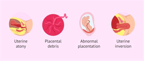 Postpartum Hemorrhage