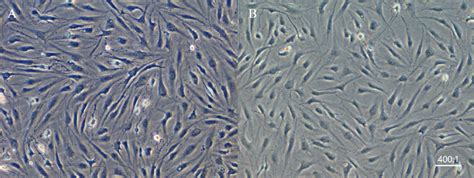 Morphology of chondrocytes in the 2 groups (×100). A. Chondrocytes in ...