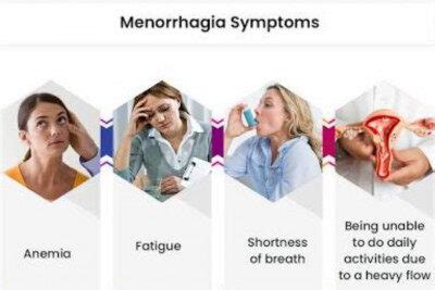 MENORRHAGIA - Nurses Revision