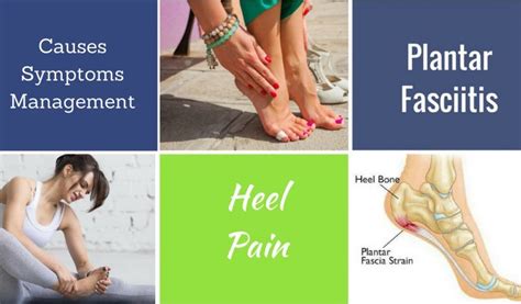 How to Deal with Heel Pain or Plantar Fasciitis? – all things GUD!