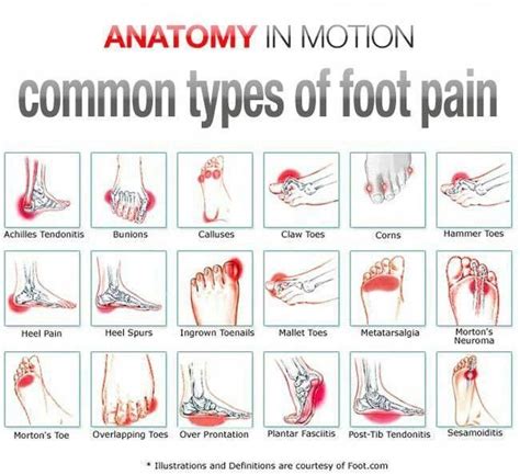 Pin on Massage Pressure Points