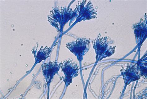 Lactophenol Cotton Blue (LPCB): Principle and Procedure for Fungal Staining | LaboratoryInfo.com ...