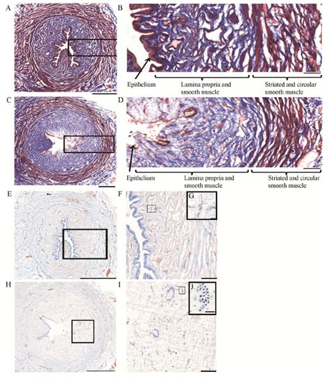 A-D. Masson’s trichrome examples from a saline (A, B) and 0.5% acetic ...