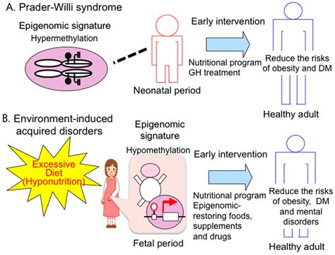 Prader Willi Syndrome Diet - Quotes Home