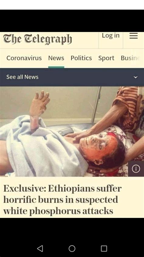 Ethiopians suffer horrific burns in suspected white phosphorus attacks ...