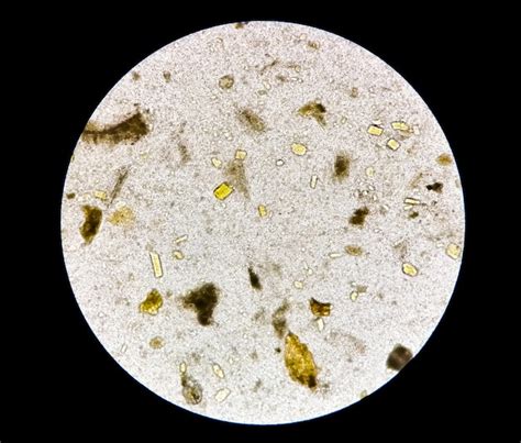 Stool Analysis Under Microscope at Edward Prieto blog