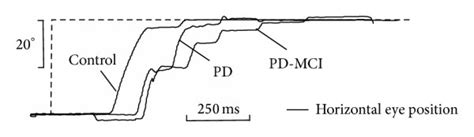 Horizontal smooth pursuit eye movements (SPEM) elicited by a sinusoidal... | Download Scientific ...