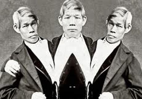 Japan: Scientists to Unearth Remains of Famous Siamese Triplets | Triplets, Famous, Japan