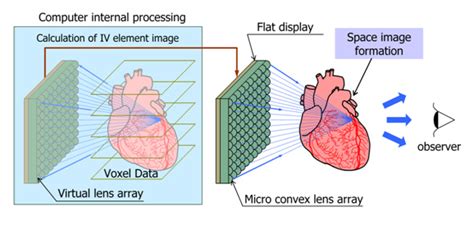 NVIDIA CUDA: Naked-Eye Stereoscopic System for Real-Time Medical Imaging