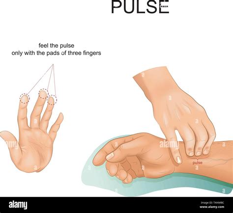 Ilustración vectorial de la palpación del pulso correcto Imagen Vector ...