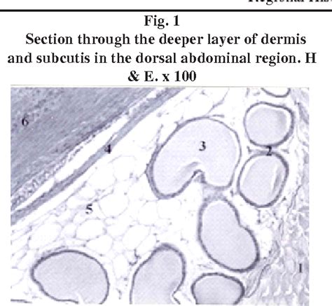 Figure 3 from Regional histology of the subcutaneous tissue and the ...