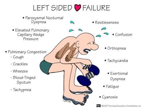 Heart-symptoms: Left sided heart failure