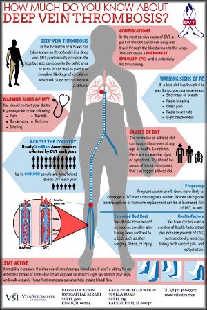 Deep Vein Thrombosis - Vein Specialists of Illinois