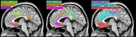 Anterior Cingulate Cortex: Unique Role in Cognition and Emotion | The Journal of Neuropsychiatry ...