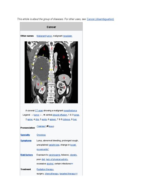 Article About Cancer | PDF | Cancer | Clinical Medicine