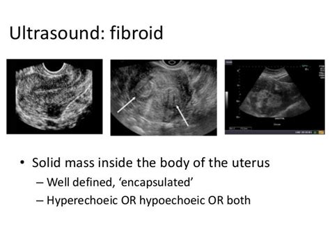 Basic gynae ultrasound