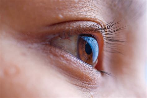 Could Your Watery Eyes Be a Sign of a Blocked Tear Duct? - FOCUS - A health blog from Mass Eye ...