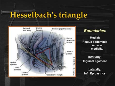 Inguinal Hernia Anatomy Map | Images and Photos finder