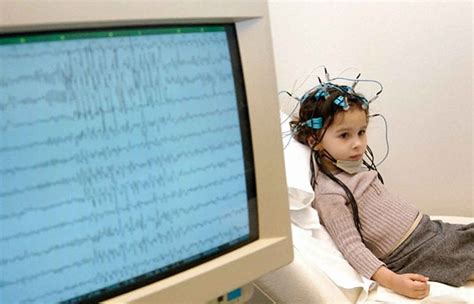 Benign rolandic epilepsy causes, symptoms, diagnosis, treatment & prognosis