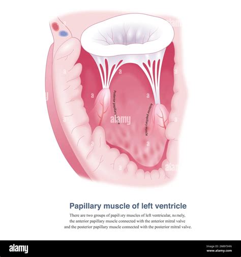 There are two groups of papillary muscles of left ventricular, namely ...