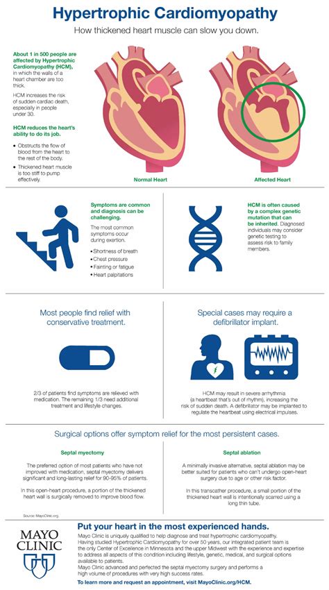 Infographic: Hypertrophic Cardiomyopathy – Mayo Clinic News Network | Hypertrophic ...