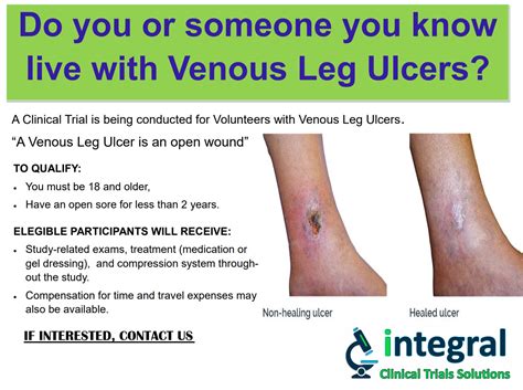 Venous Leg Ulcer - Homestead FL (Metro Miami) (Clinical Trial # 43409)