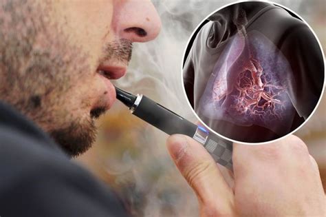 Will chronic e-cigarette use cause lung disease? - Thoracic and Sleep ...