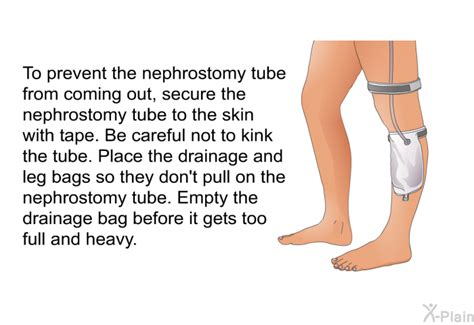 PatEdu.com : Nephrostomy Tube Care