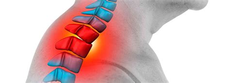 What Is A Cervical Cage - Genesis Medical Plastics