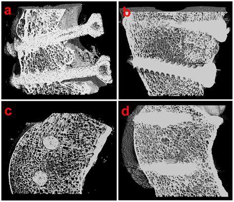 The micro-CT images of screws-bone interface taken at 12 weeks after... | Download Scientific ...