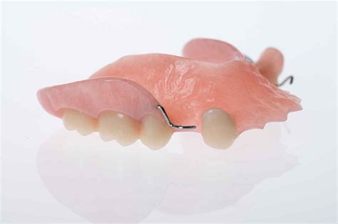 Acrylic Partial Dentures from $700 Cost & Prices Gold Coast