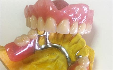 Los distintos tipos de dentaduras postizas - Clínica Larrañaga