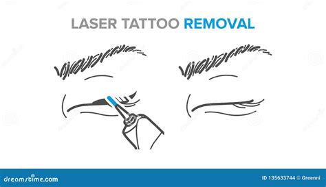 Eyeliner Removal Procedure, Laser Tattoo Removal Icons, Microblading Stock Vector - Illustration ...