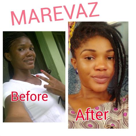 Real Whitening Skin: Learn The best skin lightening cream in nigeria