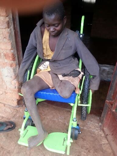 Living with a Seeping Wound in a Small Ugandan Village - Mobility Equipment for the Needs of the ...