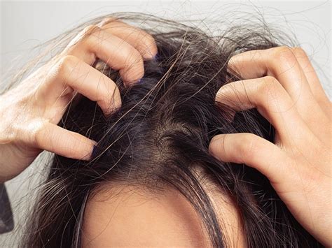 Scalp build up: Definition, causes, and how to get rid of it