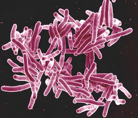 Pulmonary Tuberculosis: What is it? Causes, Symptoms and Treatment