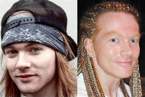 Axl Rose Plastic Surgery | Celebrity Stats