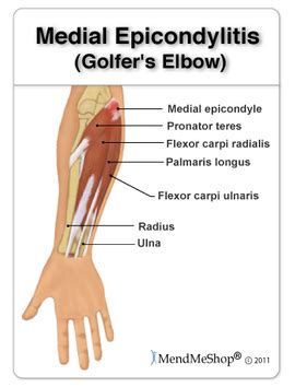 Medial - Hand & Elbow Conditions